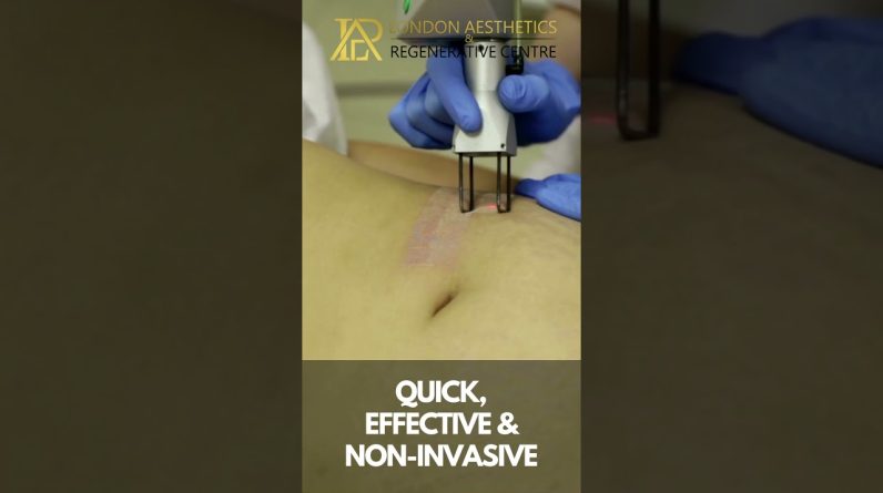 1772183623 maxresdefault