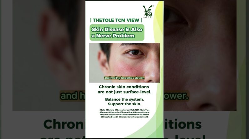 1772196112 maxresdefault