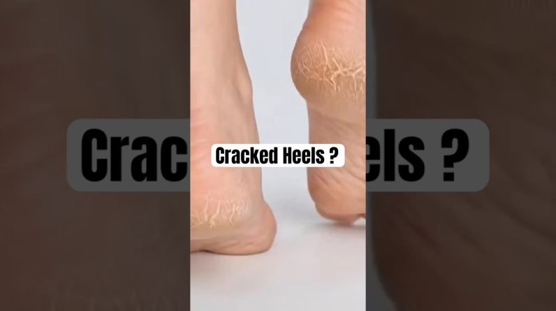 1772199765 maxresdefault