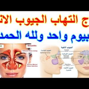 1772202770 hqdefault