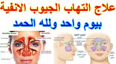 1772202770 hqdefault