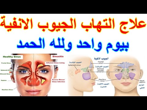 1772202770 hqdefault