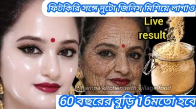 1772271888 maxresdefault