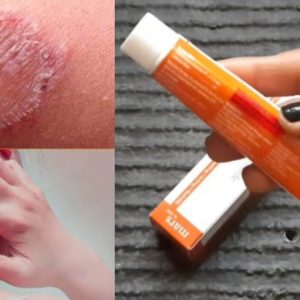 1772275551 maxresdefault