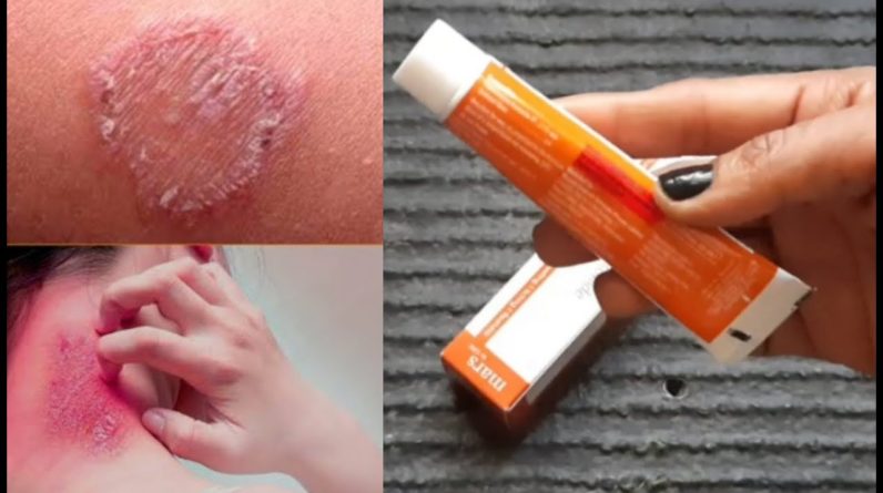 1772275551 maxresdefault