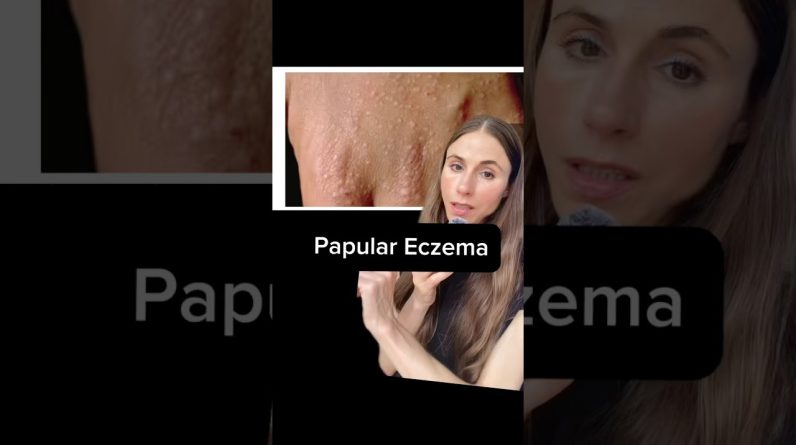 1772283885 maxresdefault