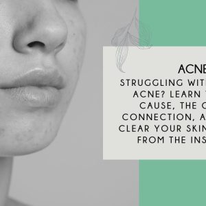 1772289974 maxresdefault