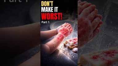 Baby Eczema Explained: Why Bath Water Makes It Worse 16 1772293608 maxresdefault