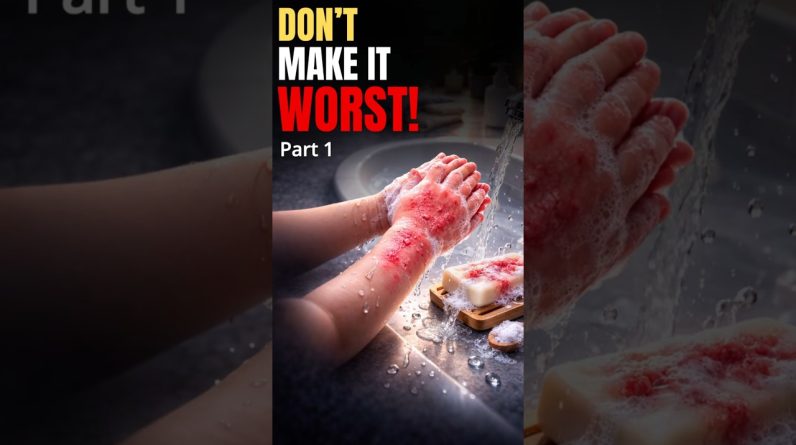 1772293608 maxresdefault