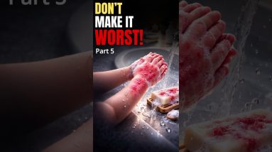 Before changing creams again… test your water. 14 1772294323 maxresdefault