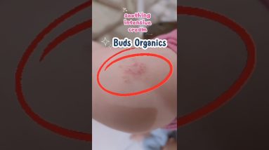 solusi kulit kering pada anak pakai buds organics #kulitkering #eksim #eczema #alergi #kulitanak 8 1772297983 maxresdefault