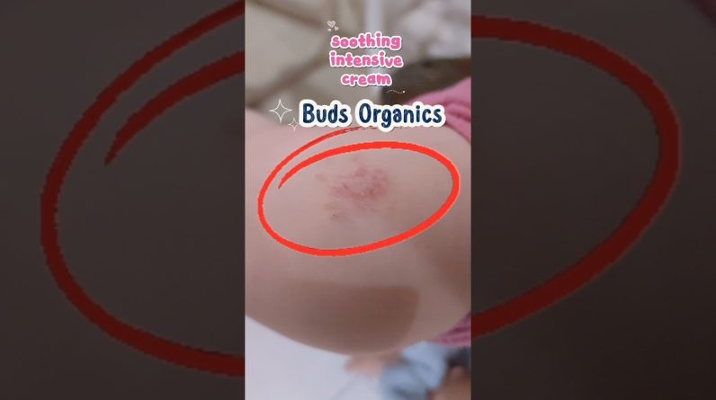 1772297983 maxresdefault