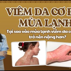 1772308244 maxresdefault