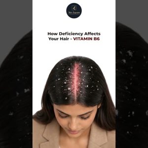 1772315563 maxresdefault