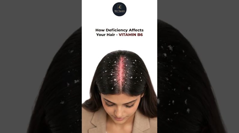 1772315563 maxresdefault