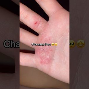 1772352589 maxresdefault