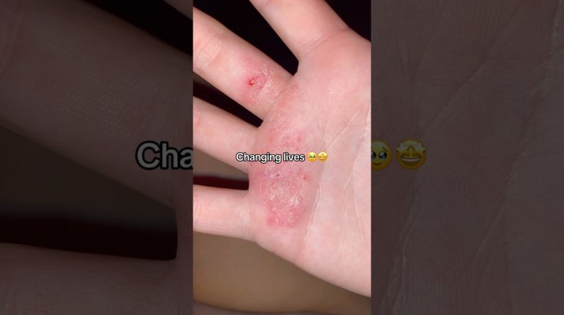 1772352589 maxresdefault