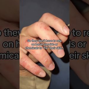 1772356303 maxresdefault