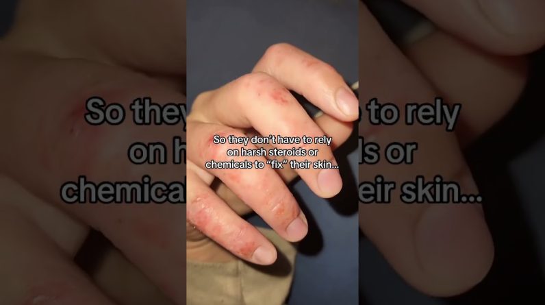 1772356303 maxresdefault