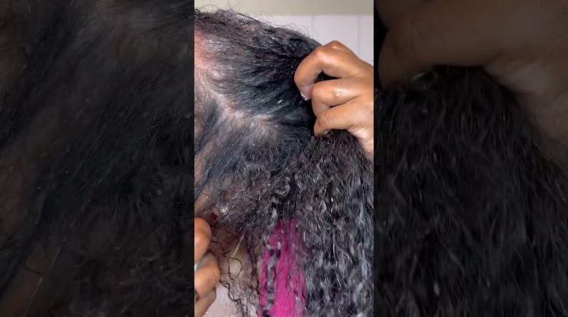 1772368256 maxresdefault