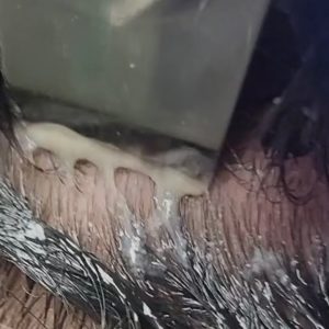 1772371909 maxresdefault