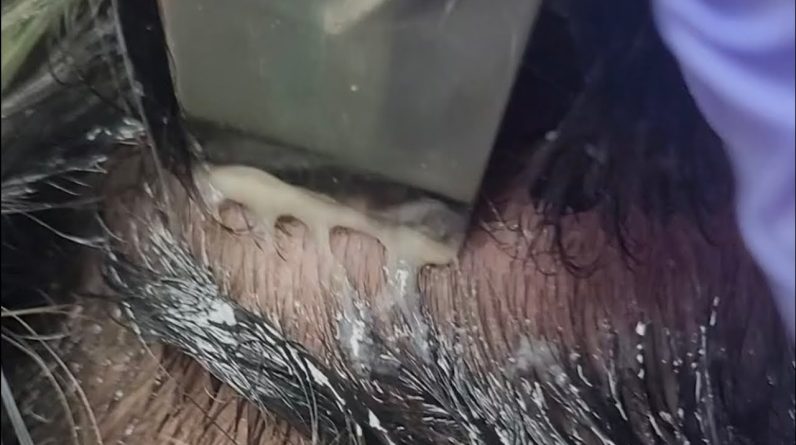 1772371909 maxresdefault