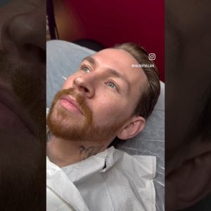 1772377785 maxresdefault