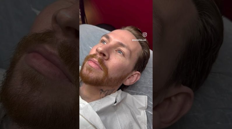 1772377785 maxresdefault