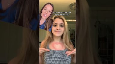 Can You Write on Your Skin? | Dermatographia 16 1772390247 maxresdefault