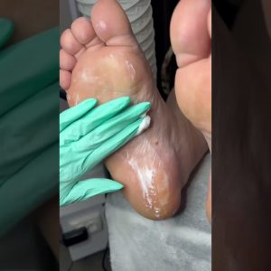 1772444549 maxresdefault