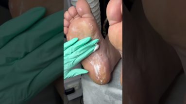 1772444549 maxresdefault