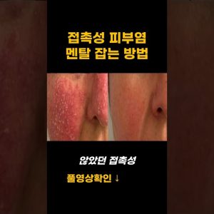 1772459824 maxresdefault