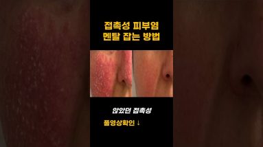 1772459824 maxresdefault