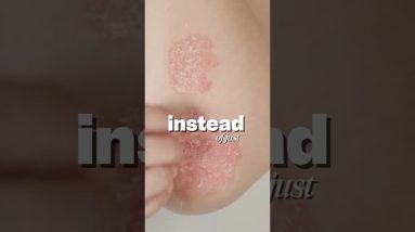 That “same old rash” might be more than just dry skin. 20 1772463464 maxresdefault