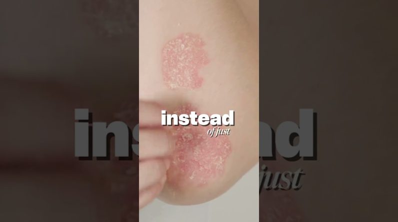 1772463464 maxresdefault