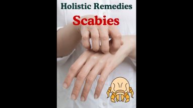 Scabies - Violent itching - Parasitic infection and natural approach 4 1772476808 maxresdefault