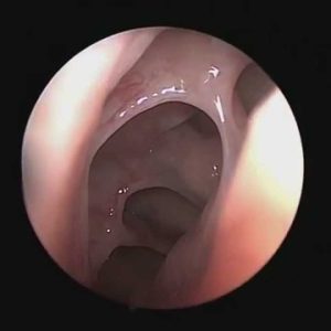 1772532433 maxresdefault