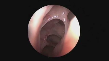 1772532433 maxresdefault