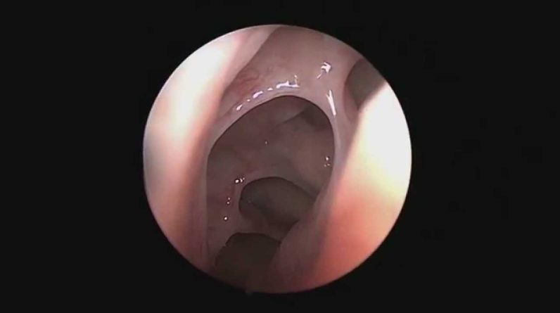 1772532433 maxresdefault