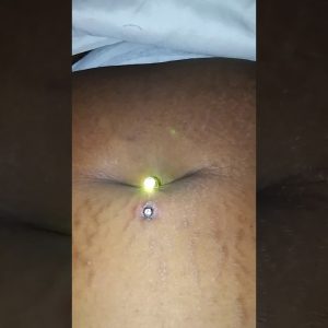 1772536116 maxresdefault