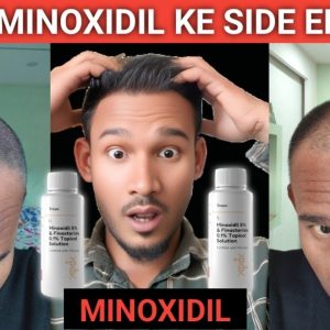 1772546265 maxresdefault