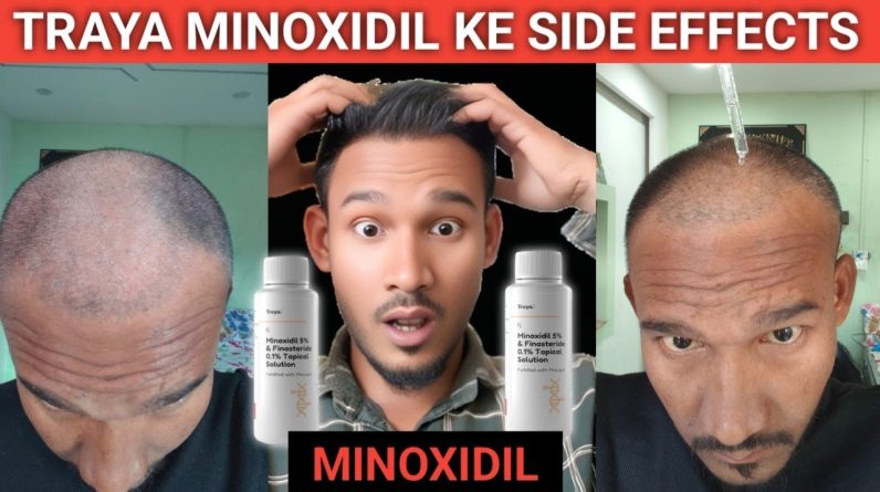 1772546265 maxresdefault