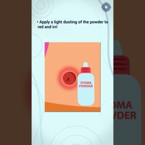 1772554245 maxresdefault