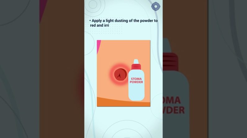 1772554245 maxresdefault