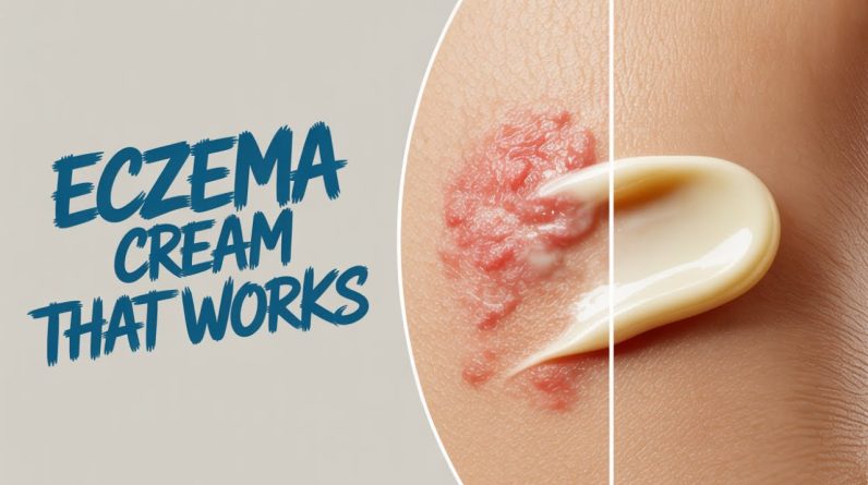 1772631489 maxresdefault