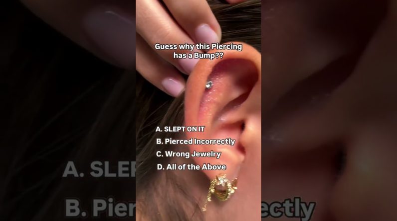 1772635064 maxresdefault