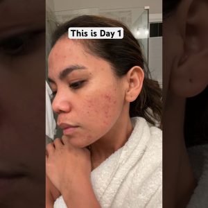 1772638867 maxresdefault