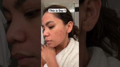 1772638867 maxresdefault