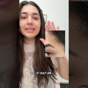 1772642551 maxresdefault