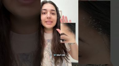 1772642551 maxresdefault